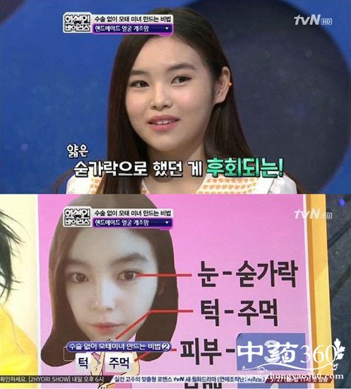 韩国母亲嫌女儿丑“动手”打成尖下巴