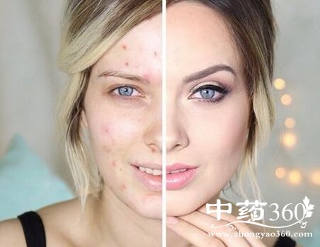 清晨皮肤美容急救法