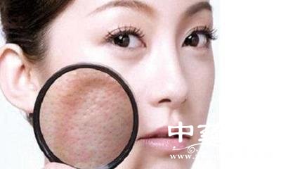 t01562c4485224ad59e.jpg t01562c4485224ad59e.jpg