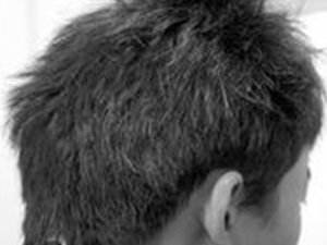 �����ٰ�ͷ��ô�죿