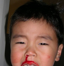 ����������Ѫ��ҽ�鷽