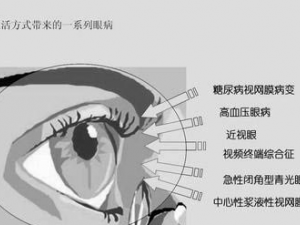 ��Ѫѹ����Ϊ��Ҫ���۵ף�