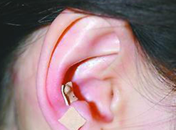 ����������֫������ö�Ѩ��ҩ