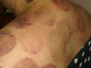 ��������ξ�׵Ч���ܺ�