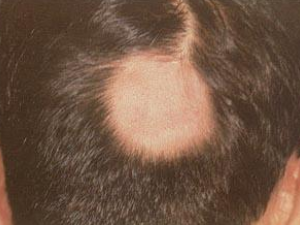 �������ư�ͺ��ƫ��