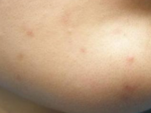 ��ҽ����������ӡ