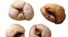 ��ҩ�� �㱴ĸ