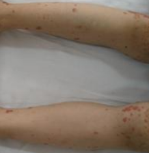 �ι�������񰷽