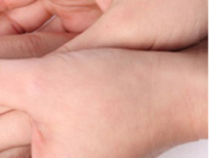 ͨ��Ƥ����ָ�׵ı仯�ж�����״��