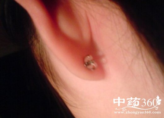 MM打耳洞牢记八个健康小贴士