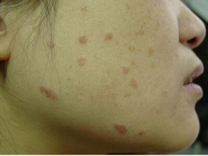 ʲô�Ǳ�ƽ�� ��ƽ���ʲô ���Ʊ�ƽ����ҩƫ��