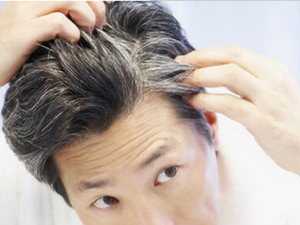 ��ͷ�����ı�׵Ļ�ϰ�� ���Ԥ����ͷ��������