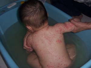 С��ʪ���ԭ�� ʪ��ĵ��� ʪ������Ʒ���