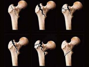 �������ɳ�ʲô�ã����Ƽ�����ʳС��ʿ