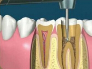 ���������׵�֢״ ������������ô��