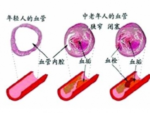 Ѫ˨���ߴ�������껼��