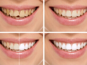 �������׵����� �������׵�С����