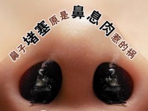 ��Ϣ��Σ���� ��Ϣ���֢״��Ԥ��