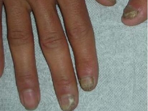 ָ׵֢״ ָô ָ׵ƫ