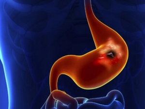 θϢô θϢλ θϢƫ