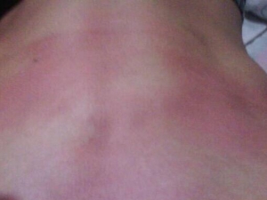 Ƥ������������ô�� Ƥ���������׵�ע������