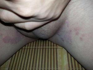 ���ҳ�ʪ������ԭ�� ���ҳ�ʪ������ô��