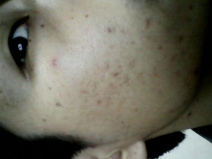 ɫ�߶���ô�� ȥ��ɫ�߷����Ƽ�