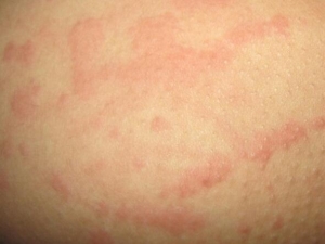 �ǻ�Ƥ������ Զ��Ƥ������