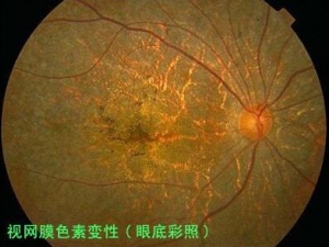 ����Ĥɫ�ر�������ô���� ��֪�����֪ʶ