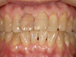 ����Ϊʲô�ᷢ�� ����û������