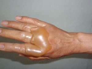 ������ô�� ���˺���ε���