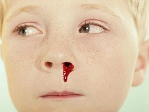 ���ӳ�Ѫ��ԭ�� ���ӳ�Ѫ��ô��