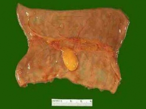 ֬�����Ĳ��� ֬������ô�� ֬������ʲô��