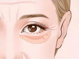 �۴������� �۴����ȥ��