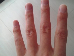 ��ָ��ͷ������ô���� ��ָ�ؽڱ�����ô��