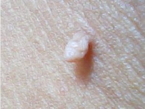 Ƥ����С������ԭ��