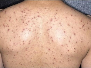 �ļ�����Ƥ����������ô�� ����Ƥ�������໤��