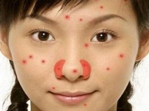 ��Щ��λ���׳����� ��������ԭ��