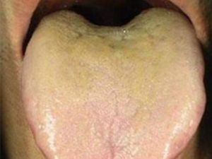 ��̦��Ƶ�ԭ�� ��̦�����ô��