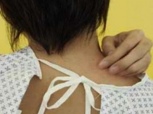 Ƥ��������֢״ Ƥ��������ô��