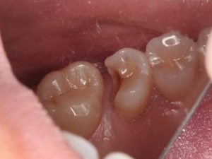 �Զ�����������ô�죿������α���