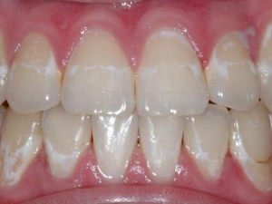 ���ȥ�������ϵİװ� �װ����Ԥ��