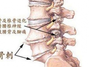 ���^̫�߮����L�Ǵ� �L�Ǵ���ô��