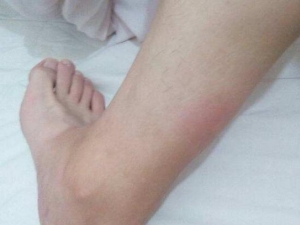 Ϊʲô���ӻ�ҧ�� ���Ԥ���ó涣ҧ