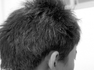 ͷ׵ԭ ͷô ͷ׳ʲô