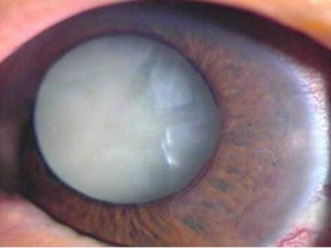 �����ϵ�֢״ ��������ϵ�ԭ�� ��������ô��