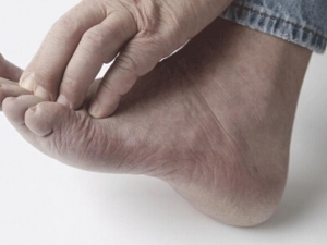 �ų���ԭ�� ��ô����ų� Ԥ���ų��ķ���