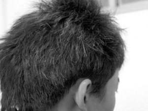 �׷���ԭ������Щ ���ư׷���ʲô��ҩ