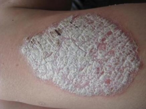 ����Ϊʲô���ţƤѢ ����ţƤѢ��ô�� ţƤѢ����ʳ����