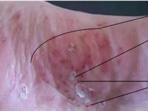 ��������Ѣ��ô�� ����Ѣ��ע������